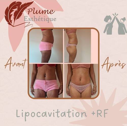 Avant / Après MINCEUR