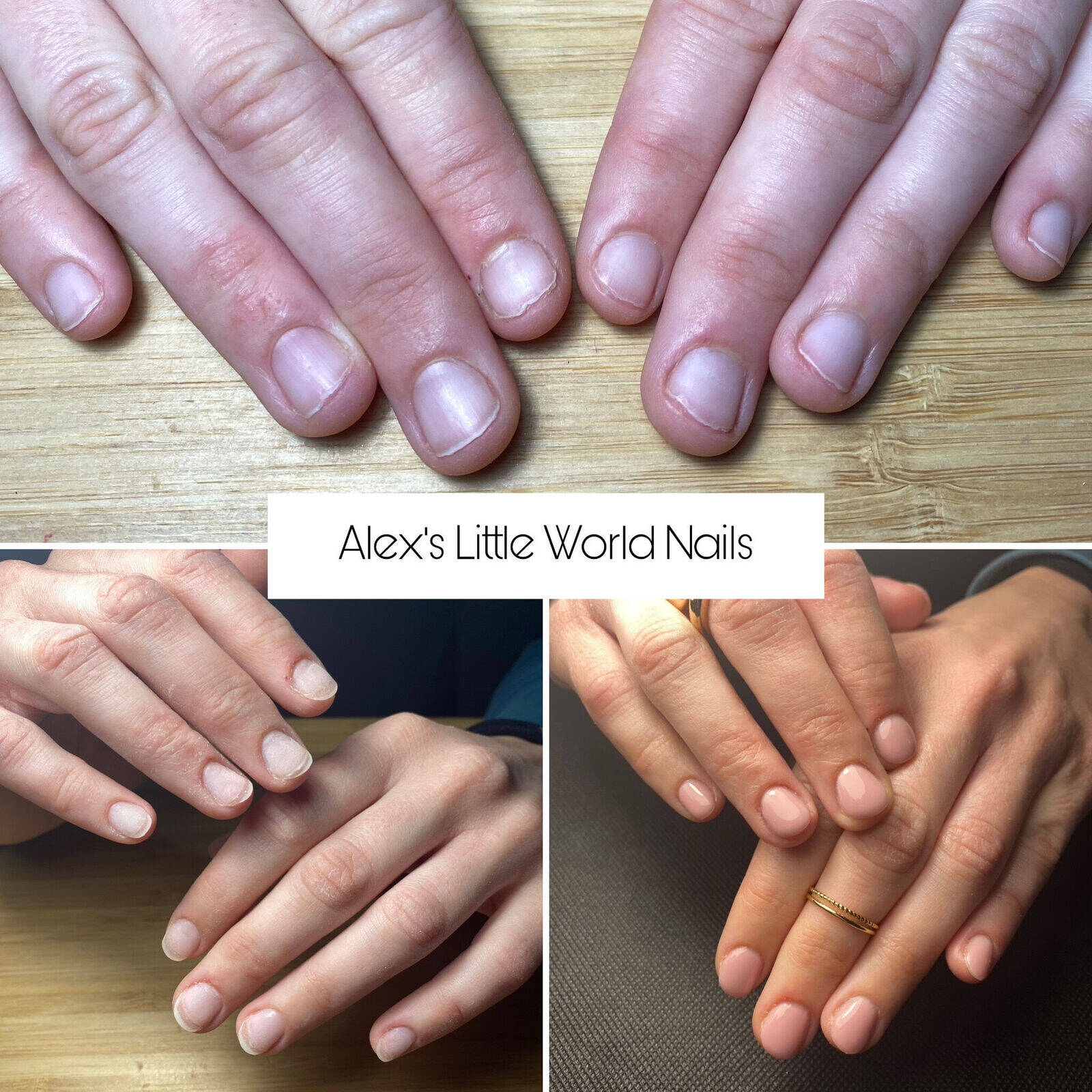 Restructuration à l’ Acrygel 