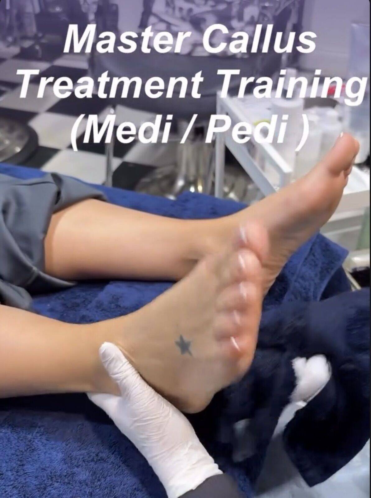 MASTER CALLUS PEEL £150 MASTERCLASS 