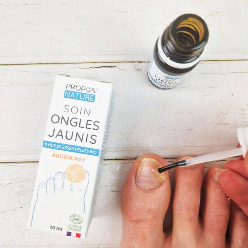 Soin ongles jaunis