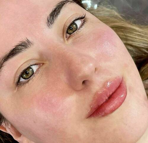 Louise/bbskin clinic/blush brow studio