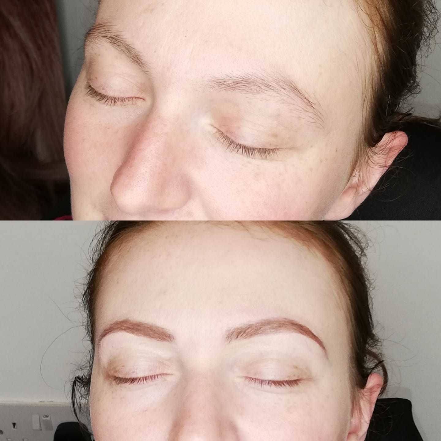 Different angle before and after