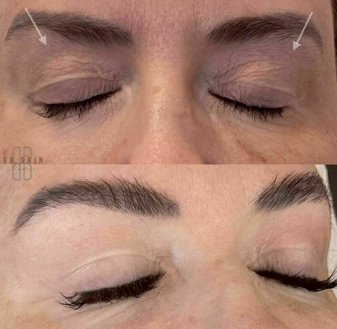 Louise/bbskin clinic/blush brow studio