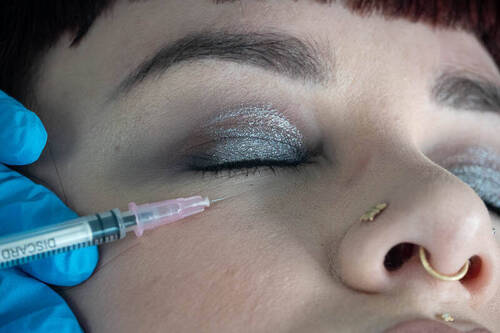 Under eye skin rejuvenation treatment 