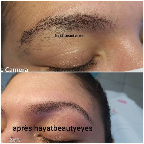 Reconstruction sourcils 