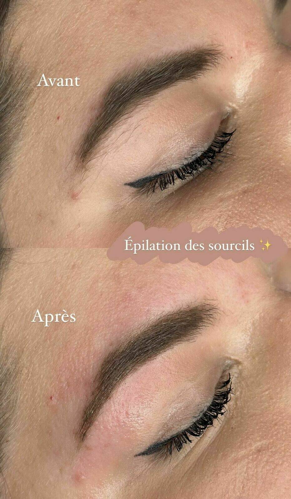 Epilation des sourcils - Avant / Après