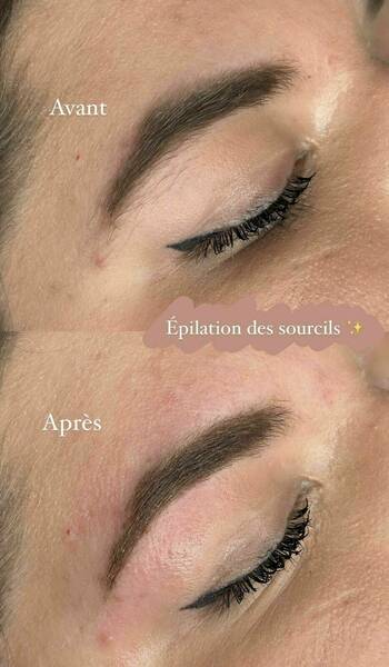 Epilation des sourcils - Avant / Après