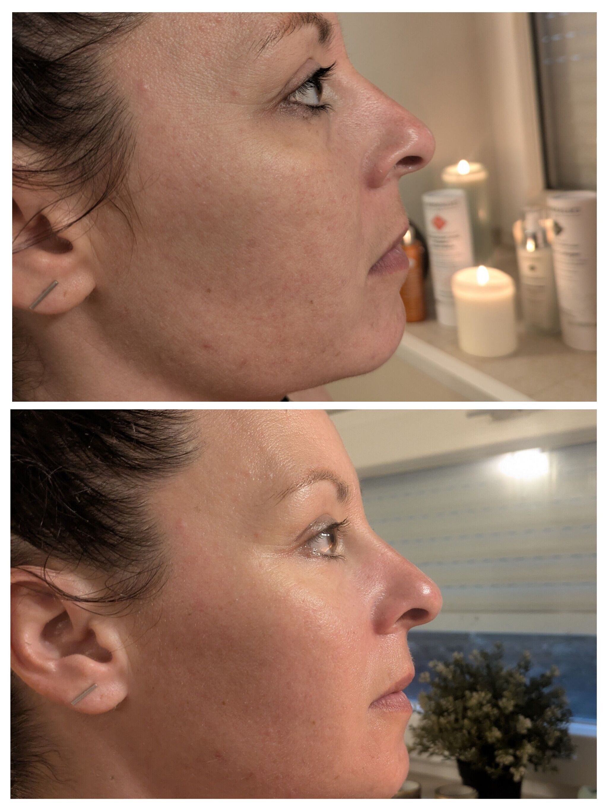Soin visage - Glow Skin