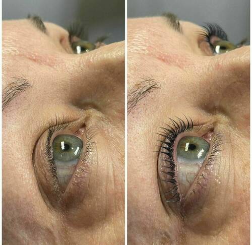 Lash Lift