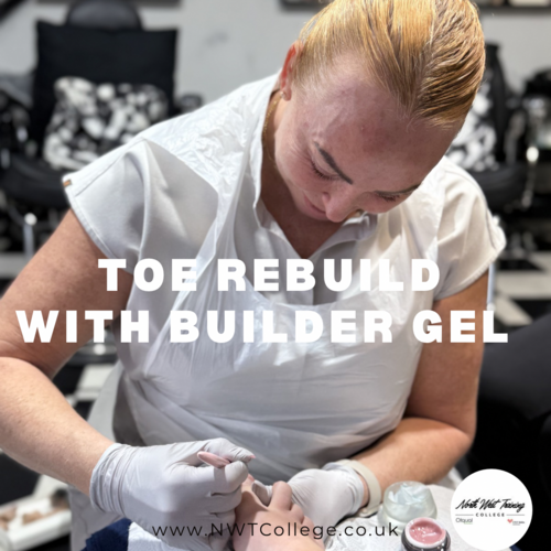 TOE REBUILD THIRS 7th MAY  10-1  price £95Deposit