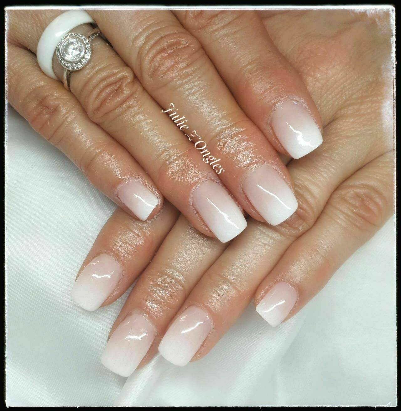 Remplissage Gel et Baby boomer 