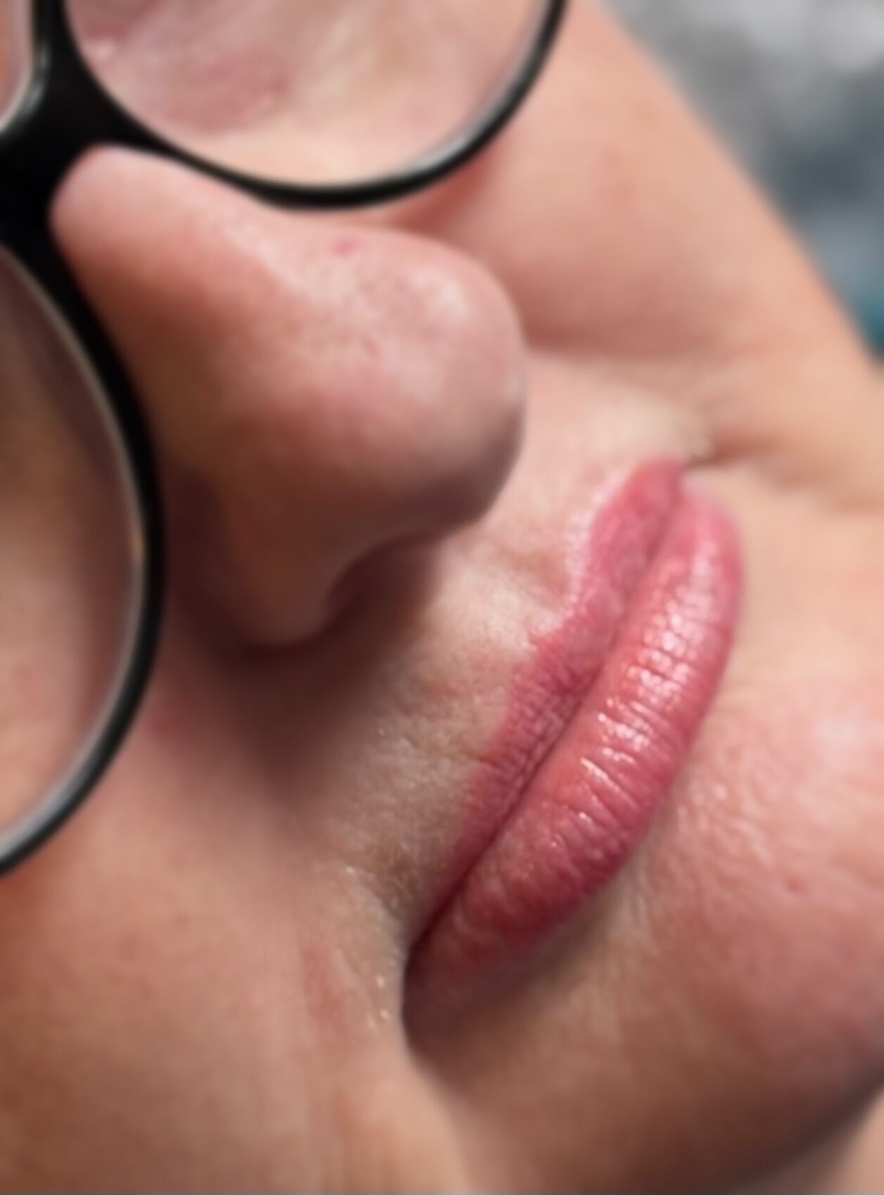 1 week healed Lip Blush 