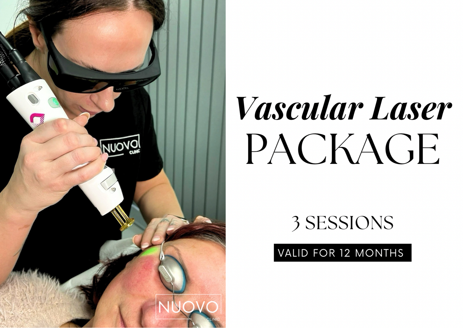 Rosacea Treatment (3 Sessions)