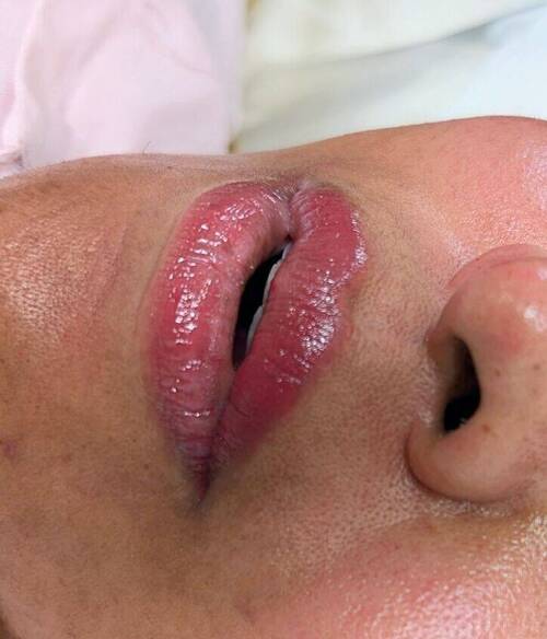 Lip Blush