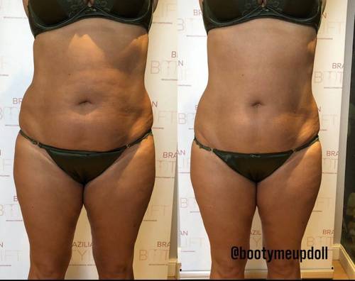 Smooth and Tone your tummy 