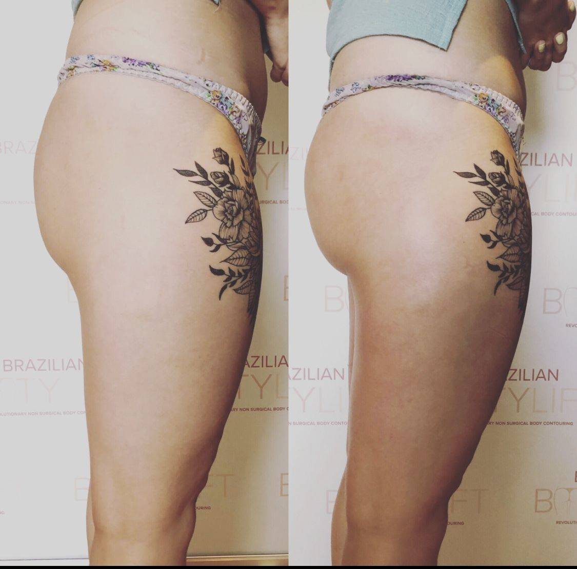 One session of Booty Lift 