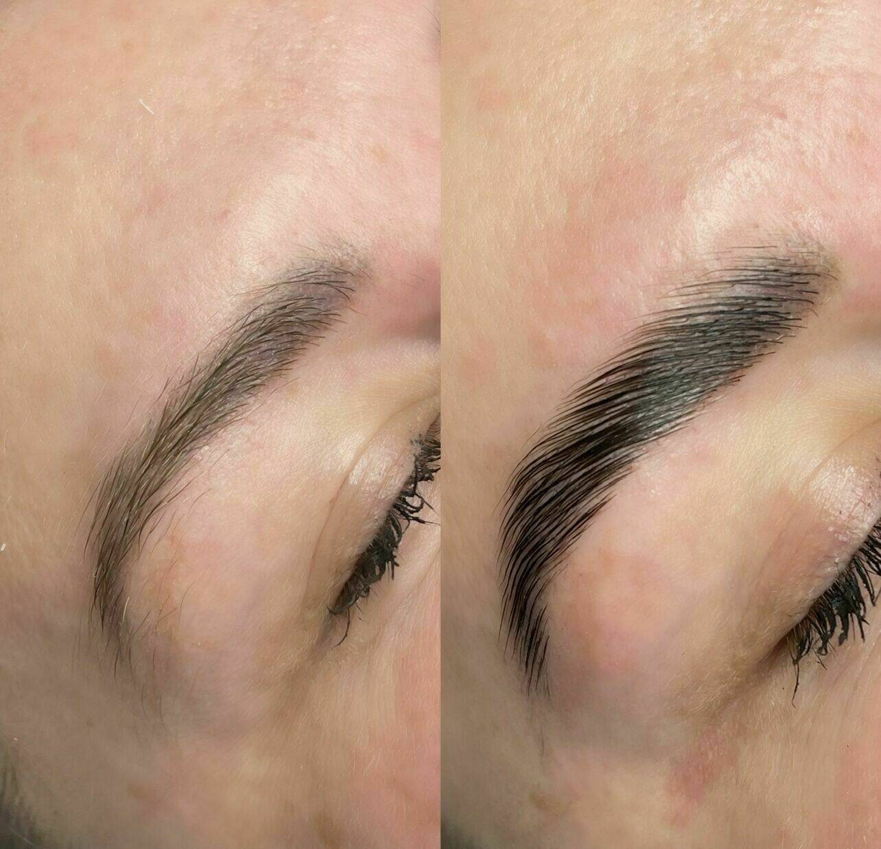 Brow Lamination
