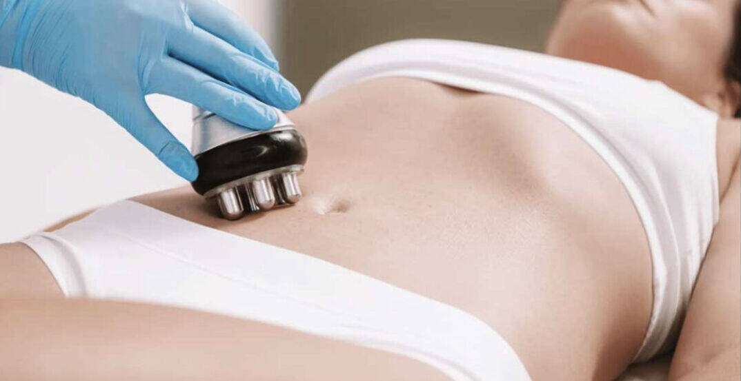 LA RADIOFREQUENCE CORPS - ventre cure de 6 soins de 30 min