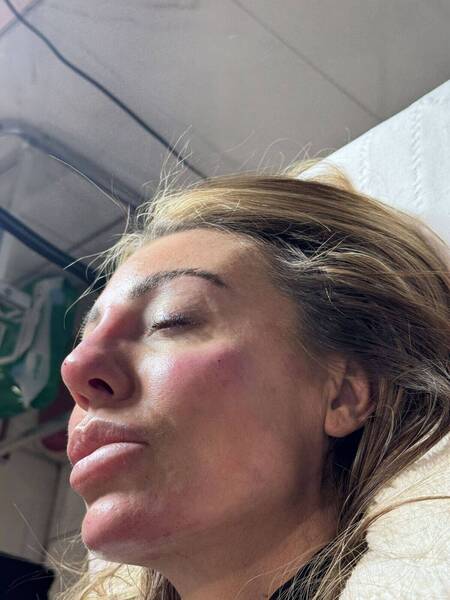 Cheek, chin, jaw and nose