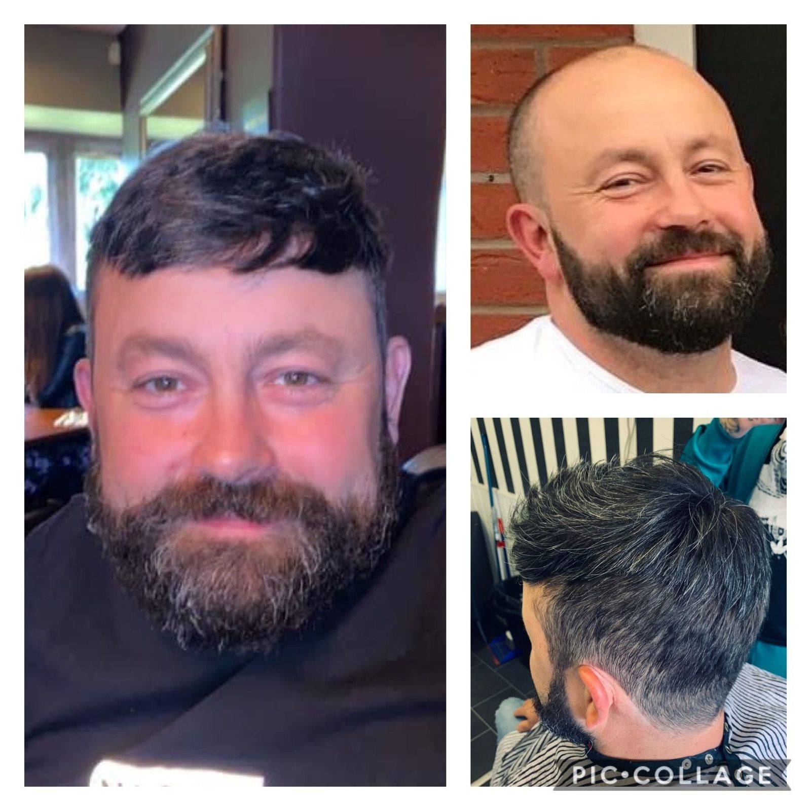 Hair Replacement 