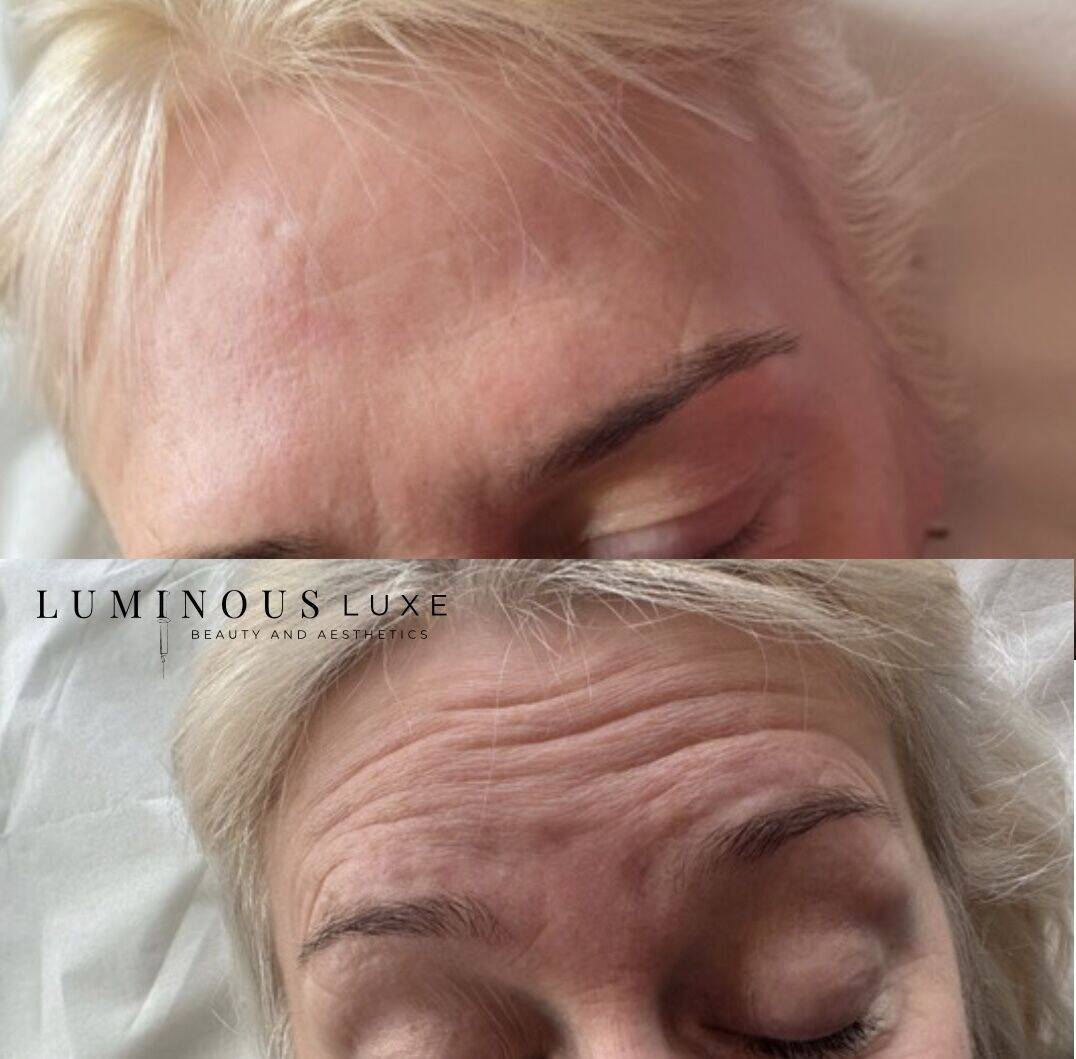 Natural enhancements 🙌🏼