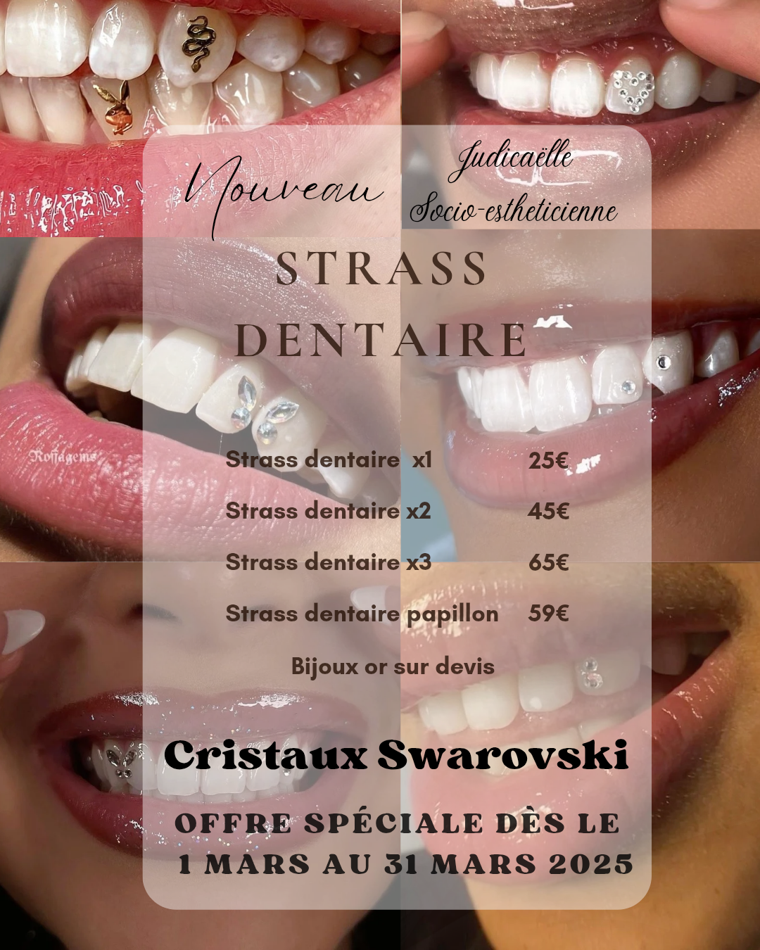 Strass dentaire 