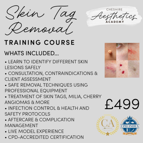 Skin Tag Removal Training Deposit