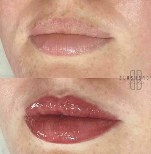 Lip blush by Louise/bbskin clinic