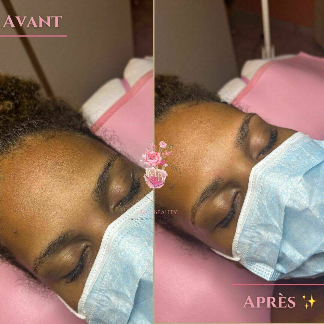 Avant/après épilation des sourcils