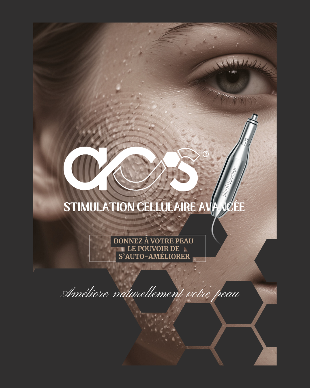 CURE ACS PEN- SKINEEDLER 5 séances