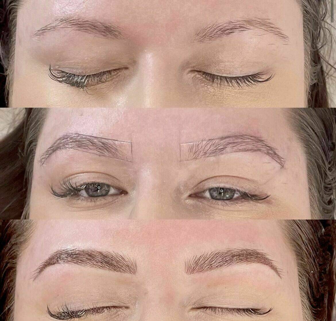 Louise/bbskin clinic