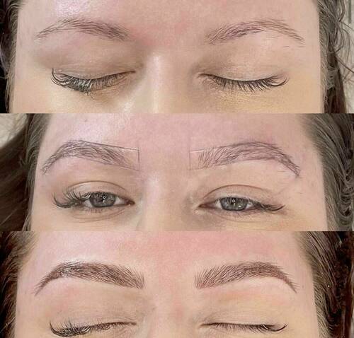 Louise/bbskin clinic