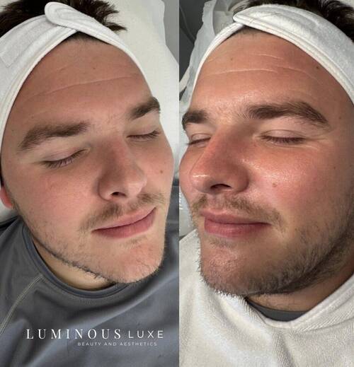 💆🏻Because clear, refreshed, healthy skin has no gender 💆🏻