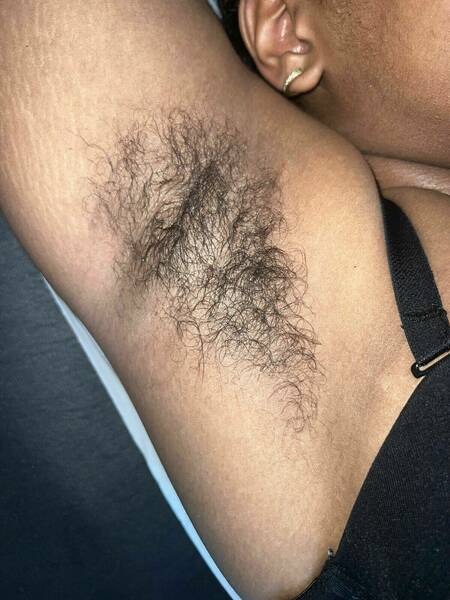 Épilation aisselles # Avant 
