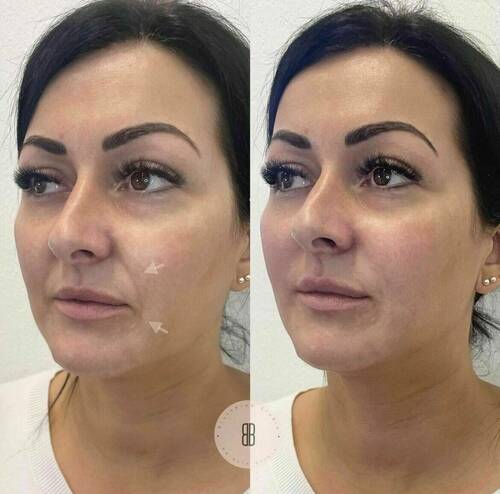 Louise/bbskin clinic/blush brow studio