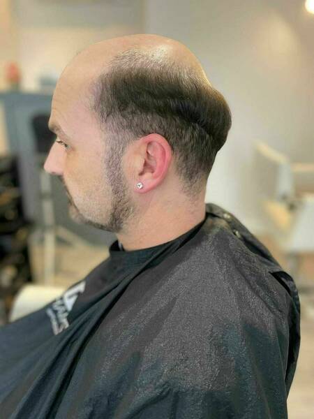 Before hair system fitted 