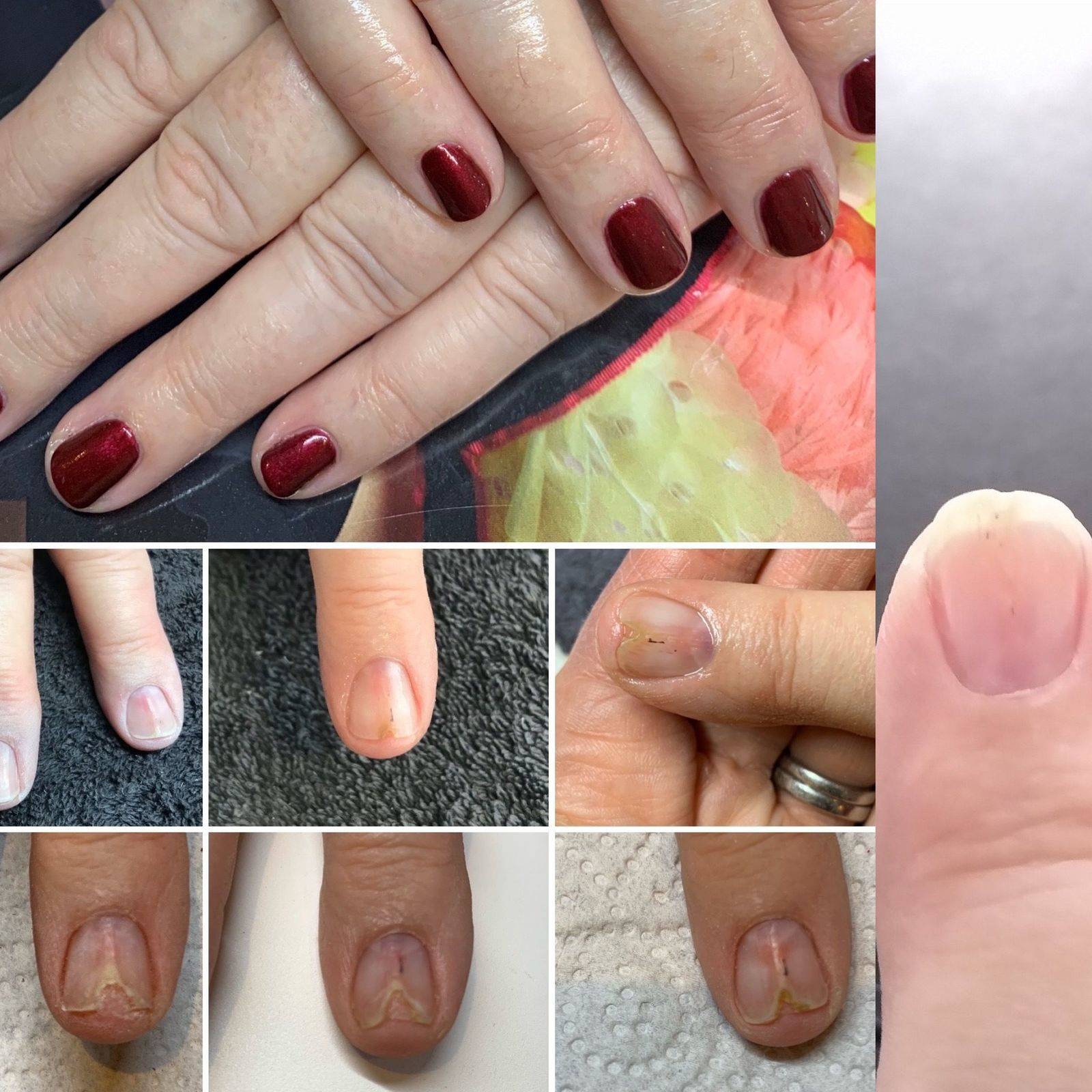 The power of Ibx. Amazing results over a matter of a weeks.