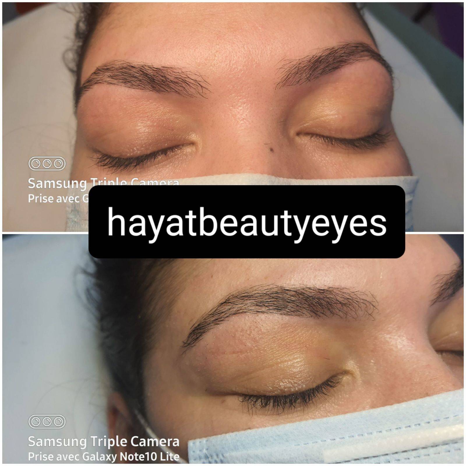 Reconstruction sourcils 