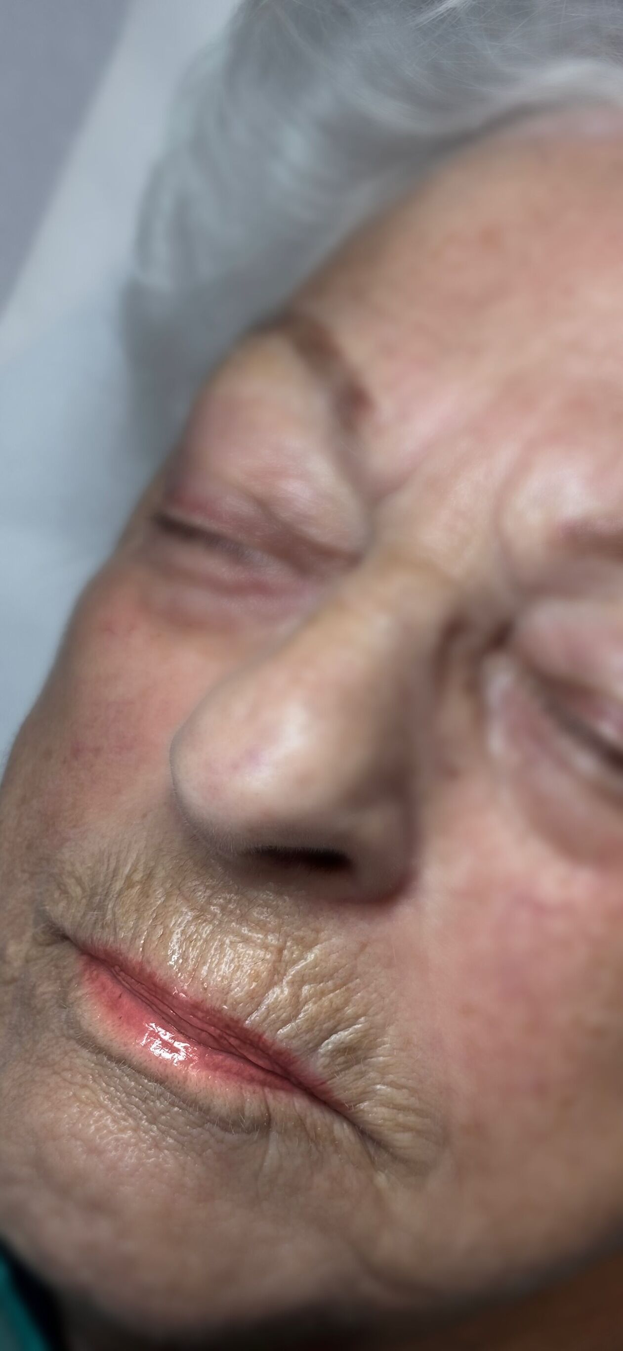 Healed Lip Blush 