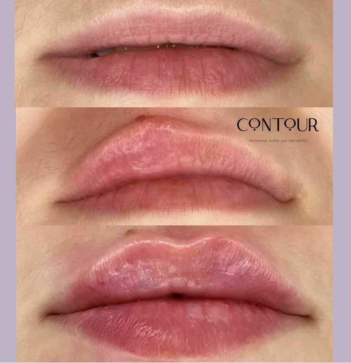 Before, During & After. 60 minutes of magic!