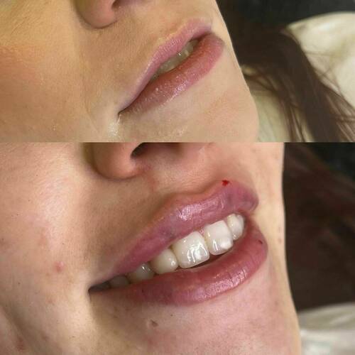 Giving you back your confidence! 