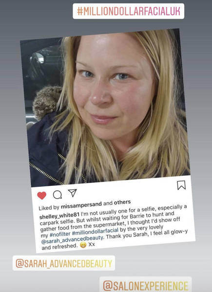 Million Dollar Facial