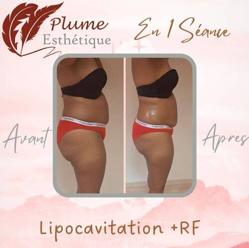 Avant/ Après MINCEUR