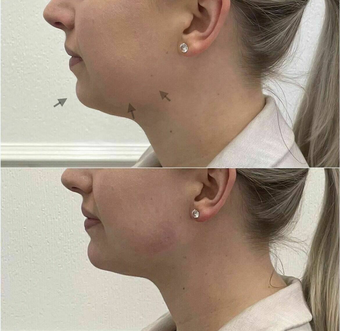 Louise/bbskin clinic/blush brow studio