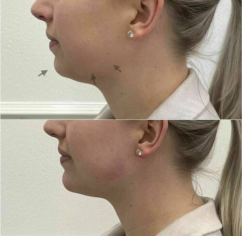 Louise/bbskin clinic/blush brow studio