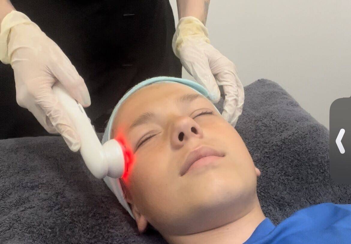 Acne treatment facial 