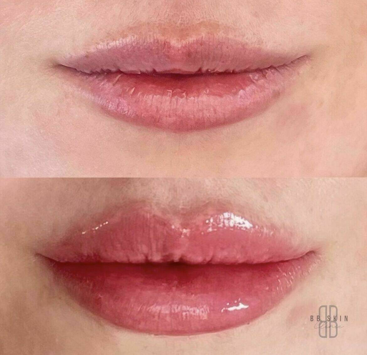 Louise/bbskin clinic/blush brow studio