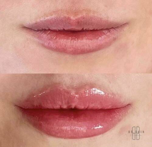 Louise/bbskin clinic/blush brow studio