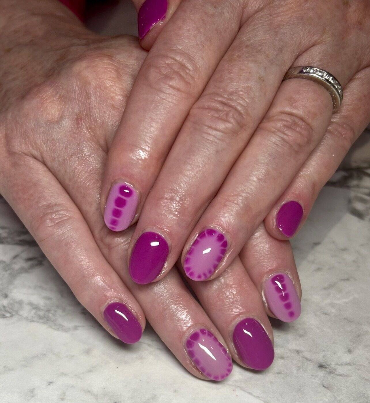 Gel Overlay