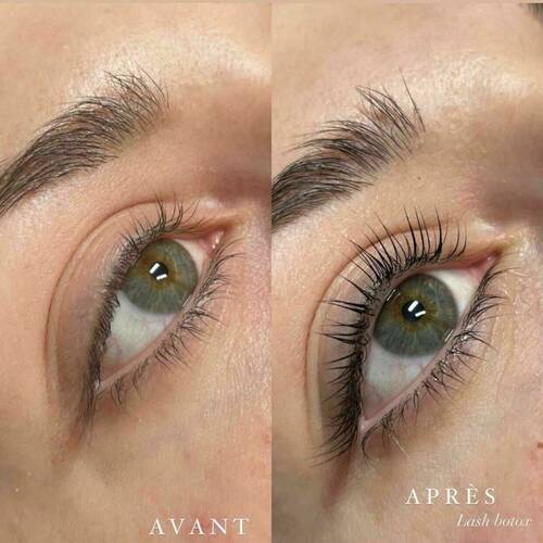 Lash Botox